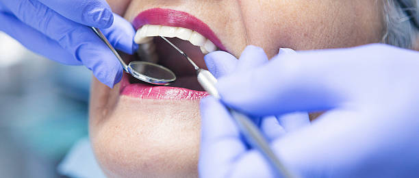 Best Emergency Dental Care for Broken or Chipped Teeth in Surf City, NC